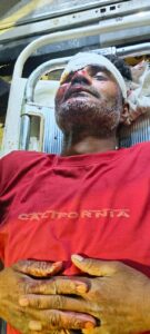 गोपालखेड़ा जाते समय युवक पर हमला, गंभीर हालत में ट्रॉमा सेंटर रेफर