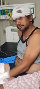 विद्युत कार्य के दौरान संविदा लाइनमैन घायल, कार्य आवंटन और सुरक्षा व्यवस्था पर उठे सवाल